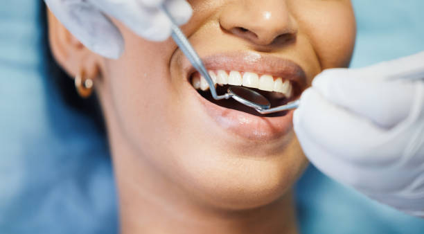 Best Emergency Gum Treatment in Virginia Gardens, FL